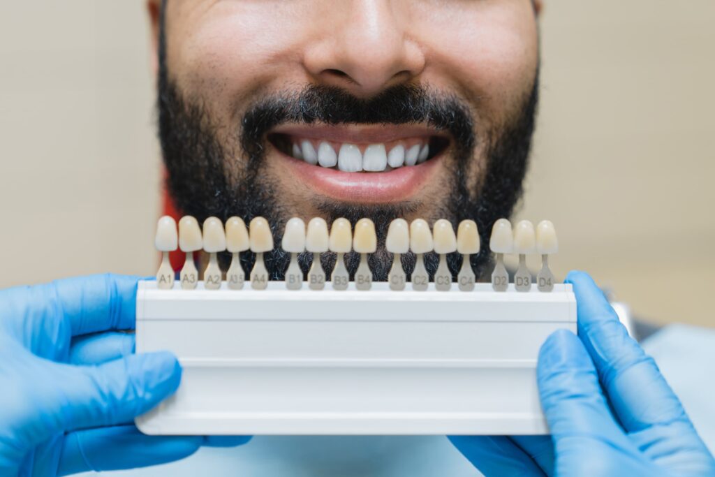 Primer plano de un hombre sonriente mostrando dientes blancos mientras un profesional sostiene una paleta de tonos dentales, ilustrando la importancia de elegir el color adecuado y seguir consejos para el cuidado de las carillas dentales.
