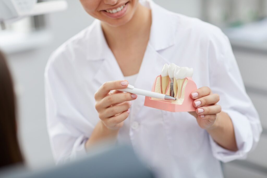 Dentista señalando un modelo anatómico de implante dental para ilustrar el proceso de colocación, mostrando el tornillo de titanio integrado en el hueso y la corona dental.