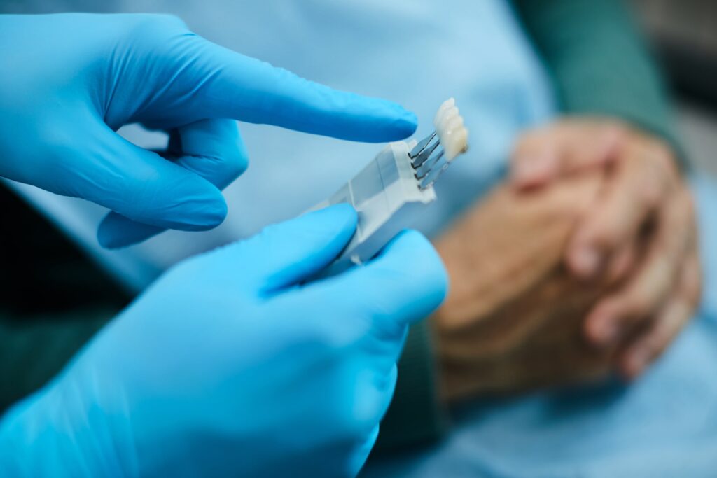Primer plano de un ortodoncista con guantes azules seleccionando carillas dentales utilizando una herramienta, representando los factores que influyen en la duración y calidad de las carillas dentales.