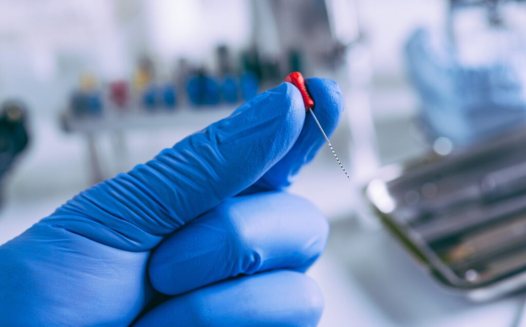 Primer plano de una mano con guante azul sosteniendo una lima endodóntica, herramienta clave en tratamientos de conductos. Imagen relacionada con el costo de la endodoncia y los procedimientos dentales modernos.