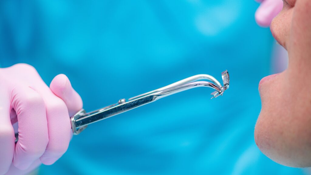 Dentista con guantes rosados sosteniendo un instrumento dental especializado frente a la boca de un paciente. Imagen que ilustra el procedimiento paso a paso en tratamientos de endodoncia.