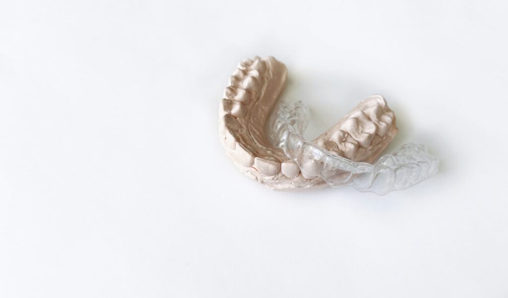 Modelo dental de yeso acompañado de un alineador transparente, herramientas utilizadas en tratamientos de ortopedia funcional en adultos para corregir la posición y mordida de los dientes de manera discreta y eficaz.