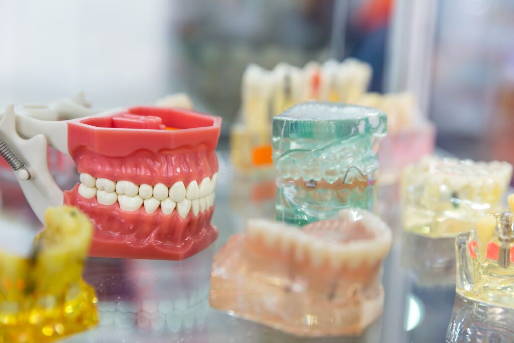 Modelos dentales y prótesis utilizados para demostrar los resultados esperados y el seguimiento del tratamiento ortodóncico, mostrando diferentes etapas y dispositivos empleados en la corrección dental profesional.
