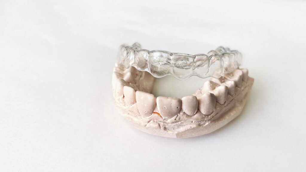 Modelo dental con férula transparente que ilustra los beneficios de la ortopedia funcional para corregir y alinear los dientes de manera efectiva