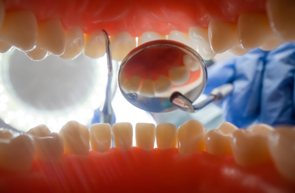Vista desde el interior de la boca durante una revisión dental, con instrumentos odontológicos y un dentista al fondo, ilustrando el proceso y la importancia de saber cómo pedir cita para un recontorneado dental en Granada en una clínica especializada.