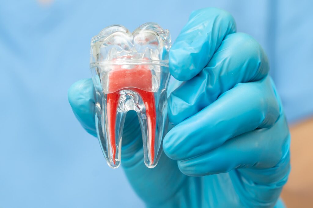 Dentista con guantes azules sostiene un modelo transparente de muela, utilizado para mostrar las promociones de implantes dentales y explicar procedimientos a los pacientes.
