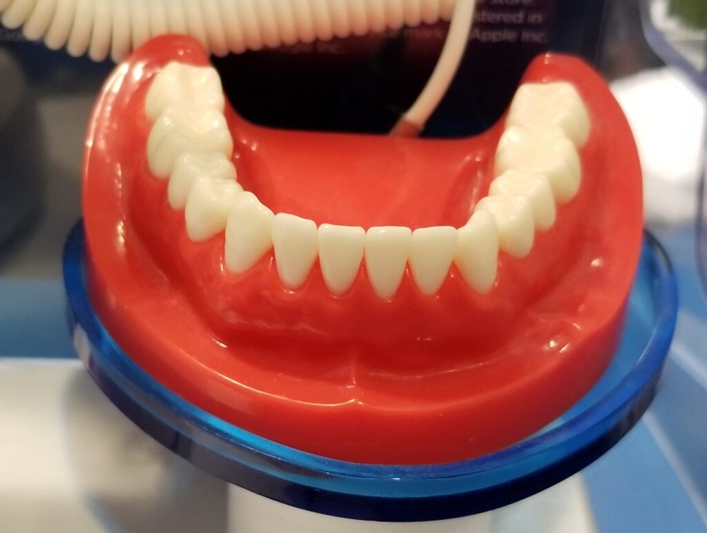 Modelo dental de encías y dientes inferiores sobre fondo azul, utilizado para explicar prácticas de salud oral y prevención, ideal para destacar la importancia del cuidado bucal en la prevención de enfermedades dentales.