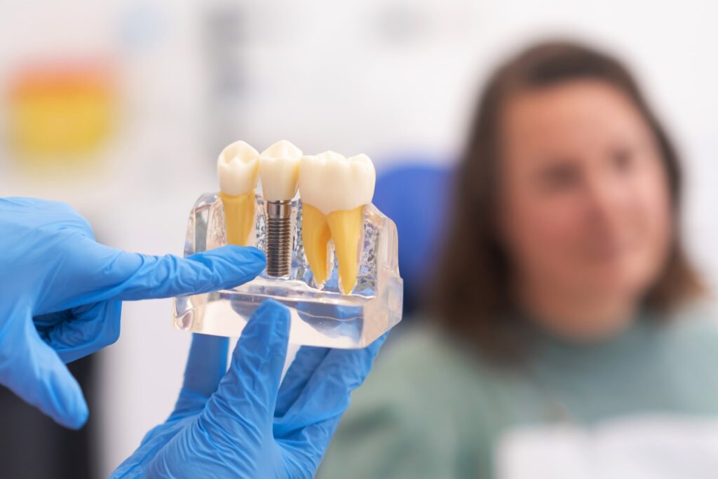 Modelo dental transparente sostenido por un odontólogo con guantes, mostrando diferentes tipos de implantes dentales y tratamientos relacionados, ideal para explicar opciones y procedimientos a los pacientes en la consulta.