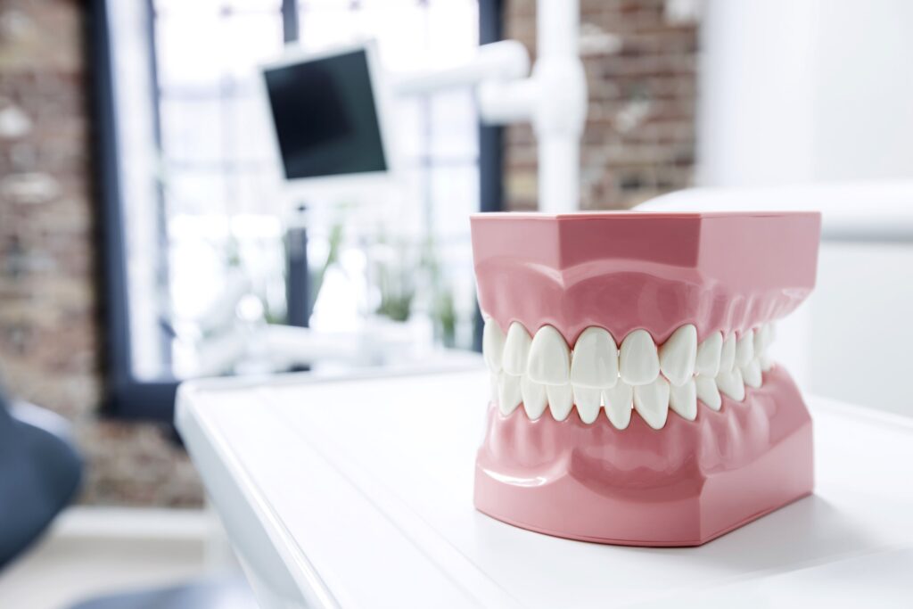 Modelo de una dentadura en un consultorio dental, utilizado para explicar cómo reiniciar la dieta normal tras la extracción dental, destacando la importancia de una transición gradual para evitar molestias y asegurar la cicatrización adecuada.
