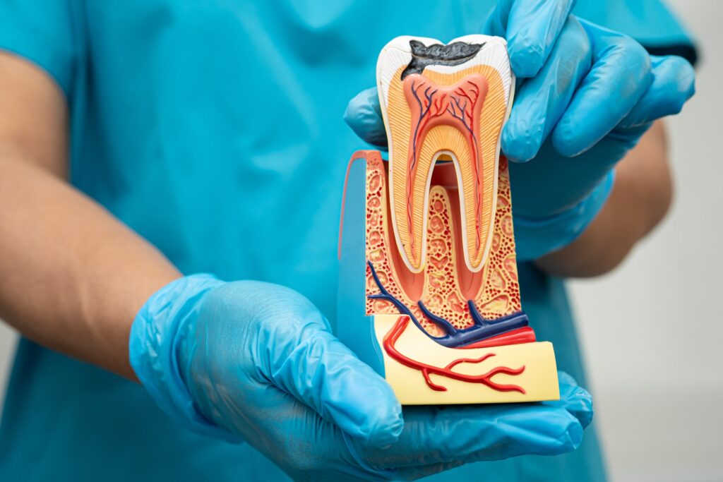 Dentista con guantes azules mostrando un modelo anatómico de diente para explicar los beneficios de la endodoncia en la conservación de la pieza dental y la salud de la raíz.