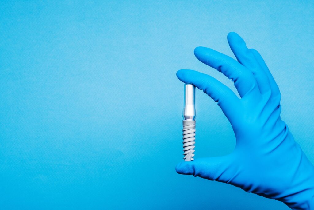 Mano con guante azul sosteniendo un implante dental de titanio sobre fondo azul para ilustrar la duración de la garantía de los implantes y los años de cobertura habituales en las clínicas dentales.